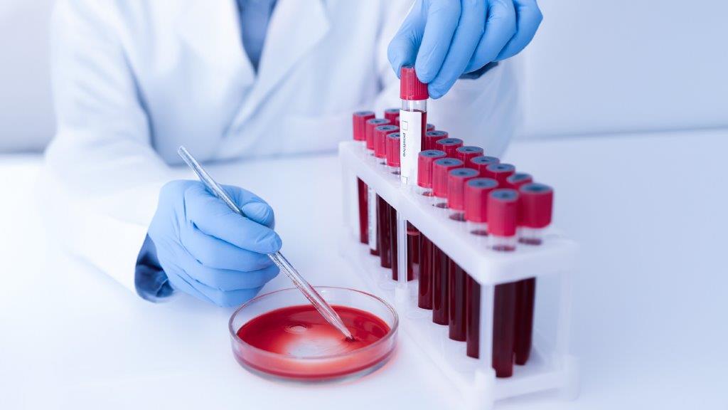 Especialistas en hematología Huancayo