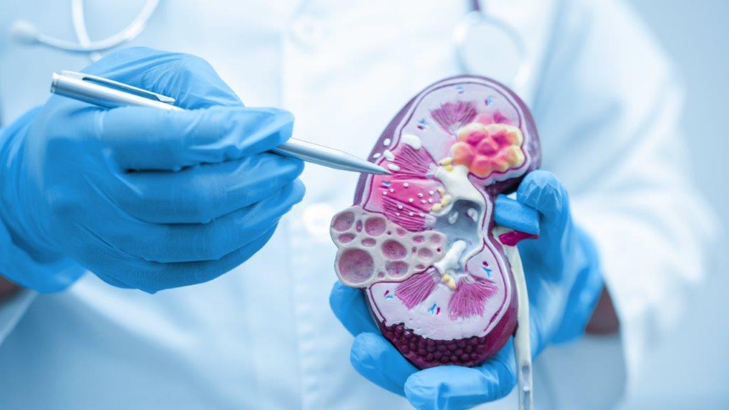 Nefrología en Clínica Ortega Huancayo